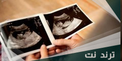 طريقة ابن سينا لمعرفة نوع الجنين