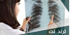 كيف يموت مريض سرطان الرئة